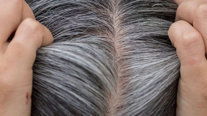 White Hair Home Remedies: You can turn white hair naturally black by applying these two things, know the method White Hair Home Remedies: You can turn white hair naturally black by applying these two things, know the method