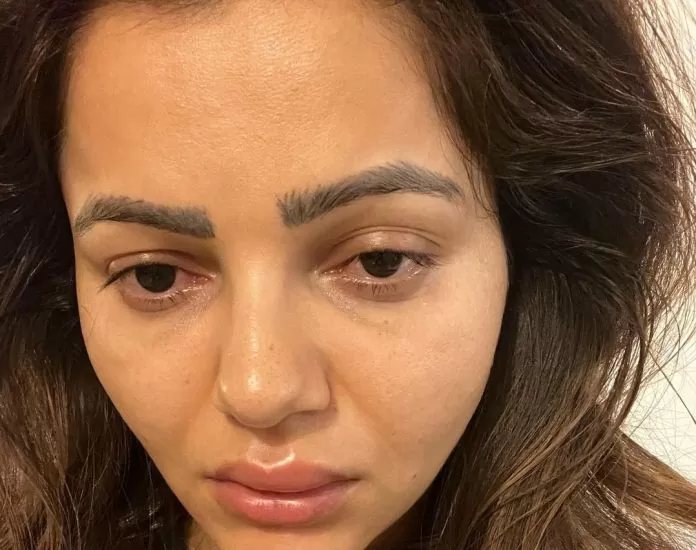 Rubina Dilaik's face is in such a bad condition, even the actress is unable to recognize herself, see photos