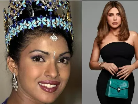 Priyanka Chopra panicked after surgery, doctors had made a big mistake, there was danger of ending her career!