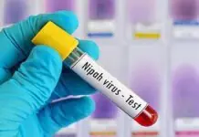 Nipah Virus West Bengal: Pune lab confirms two cases in Bengal, nurses in critical condition, 120 people in home isolation Nipah Virus West Bengal: Pune lab confirms two cases in Bengal, nurses in critical condition, 120 people in home isolation